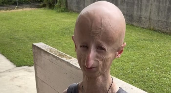 Morto Sammy Basso, l’inno alla vita che non conosceva ostacoli ci lascia a 28 anni