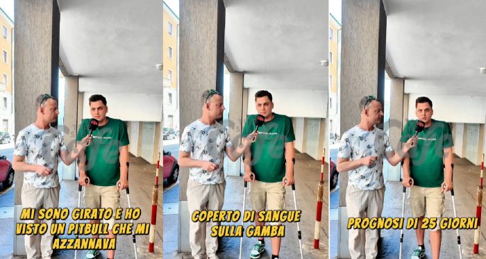 Barcola, giovane azzannato da un pitbull: “Mi ha lasciato a terra nel sangue ed è scappato” (VIDEO)