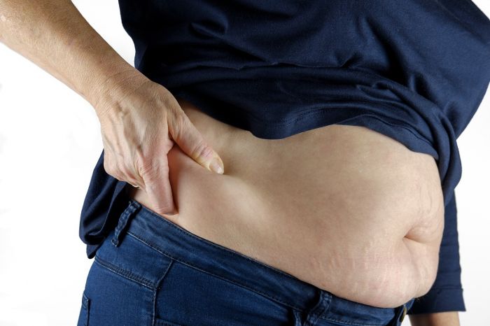 In Fvg l'11,2% della popolazione è obeso