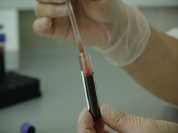 Trieste in prima linea: martedì e sabato test gratuiti contro HIV e infezioni!