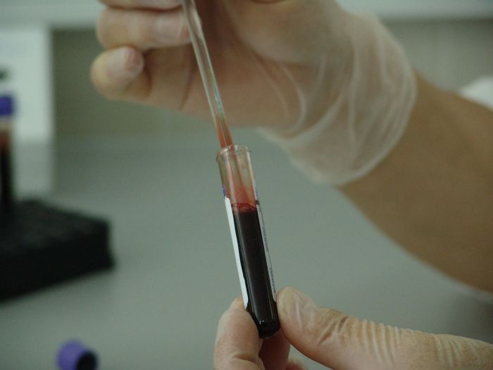 Screening gratuiti per le malattie sessualmente trasmissibili: test venerdì e sabato in via Settefontane